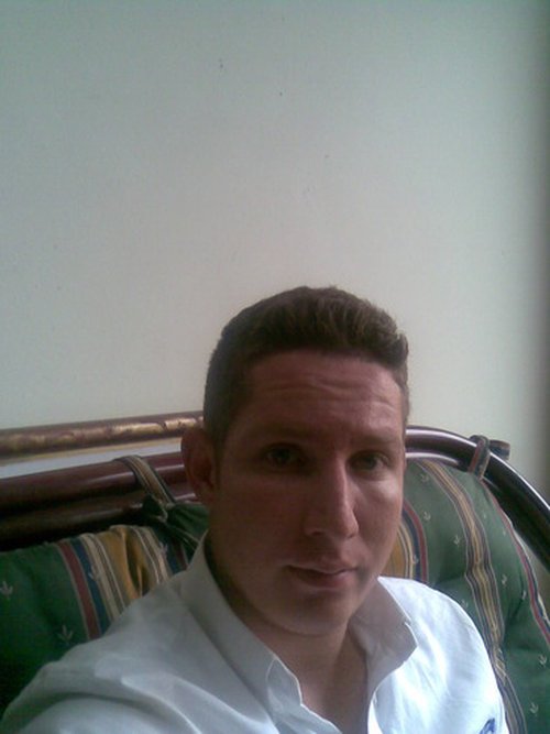Fotografia de pasometirose, Chico de 46 años